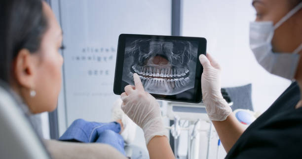 Licensed Tooth Extraction service in Aspermont, TX - Smile Center Dentistry